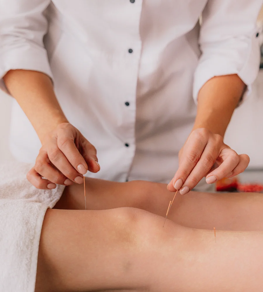 Dry needling treatment